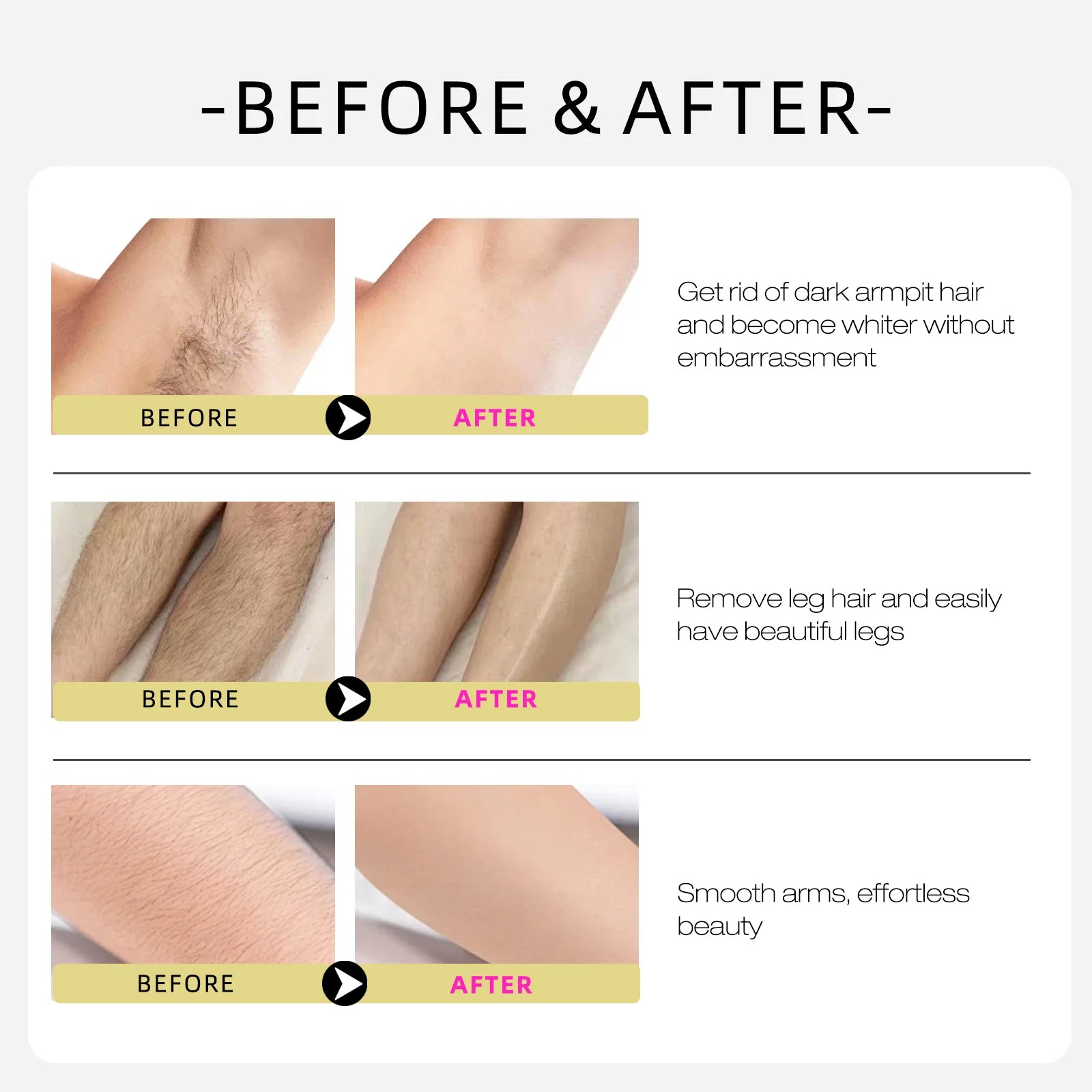 Post-Hair Removal Care Oil – Jojoba and Almond Blend Soothes Sensitivity, Locks in Hydration and Supports Daily Skin Comfort